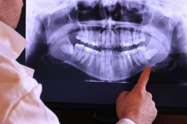 Best Tooth Infection Emergency Dentist  in Fort Valley, GA